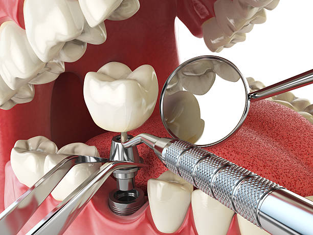 Best Emergency Dental Care for Trauma or Injury in Inniswold, LA